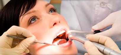 Clínica Dental Agdent odontólogo realizando periodoncia a mujer